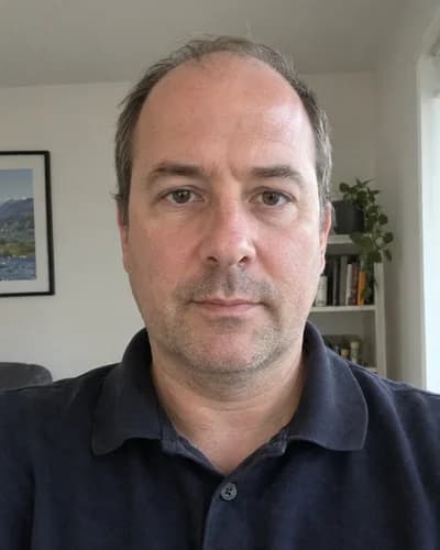Before: Receding hairline